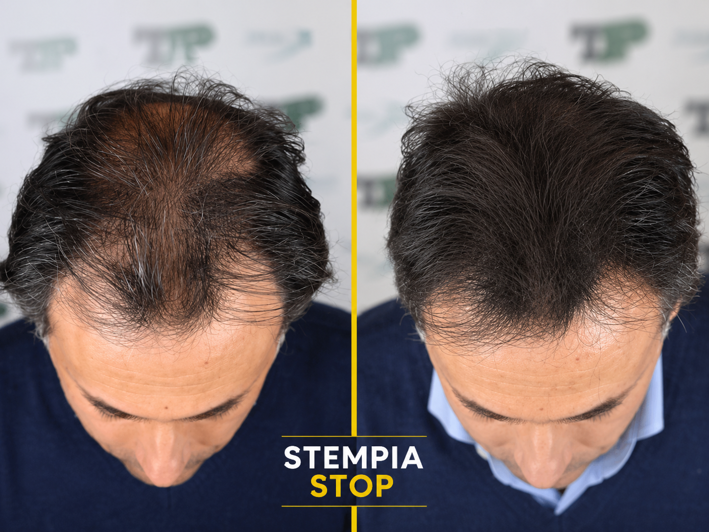 Testimonianza di Alessandro F.