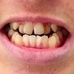 snap-on-smile-5-1.jpg
